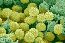 Grip Mikrobu Belirtileri ve Tedavisi Grip Mikrobu Belirtileri ve Tedavisi