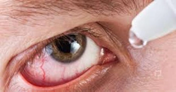 Gözün Mikrop Kapması Belirtileri ve Tedavisi Gözün Mikrop Kapması Belirtileri ve Tedavisi